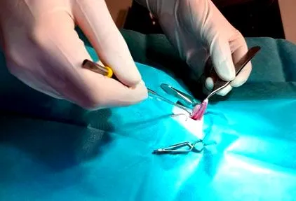 sterilizare