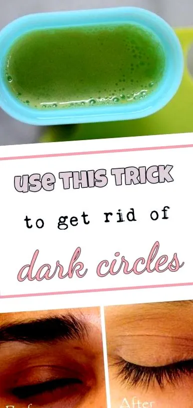 hacks