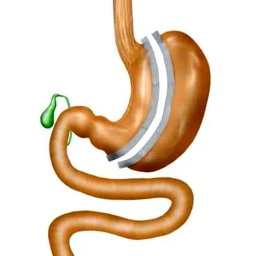 stomacului