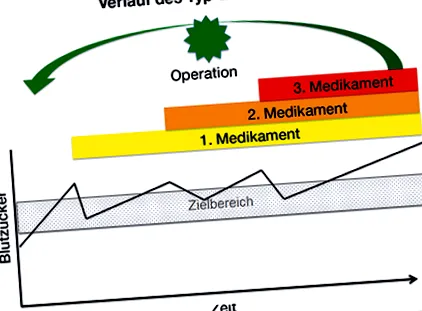 metabolikus cukorbetegség