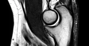 radiologic