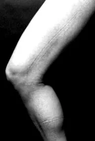 skinny