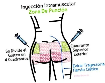 injekció