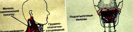 hogyan enyhíteni