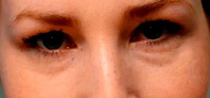 strângerea