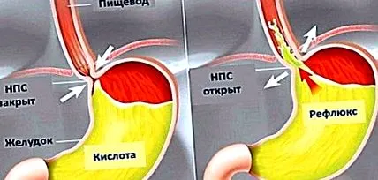 scăderea