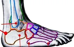 Chondropathia Patellae
