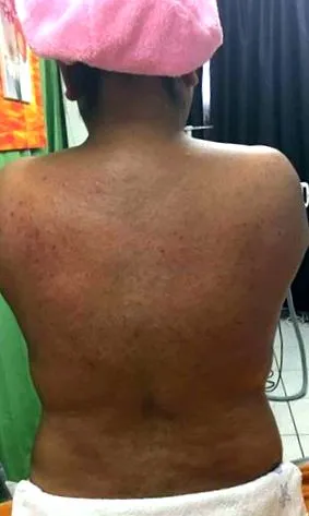 alacsony frekvenciájú