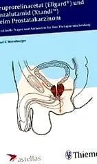 suprimarea