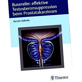 testosteronului