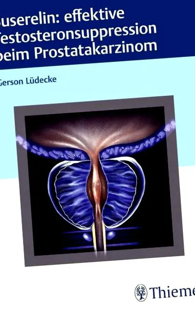 suprimarea