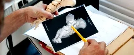 charcot-fu