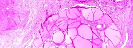 diagnosticul