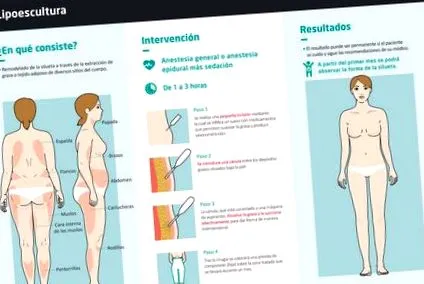 liposculpture