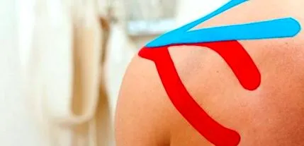kineziotape