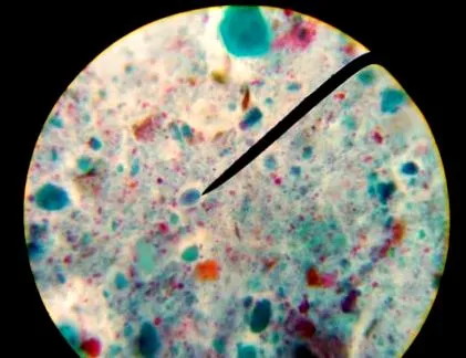 giardia