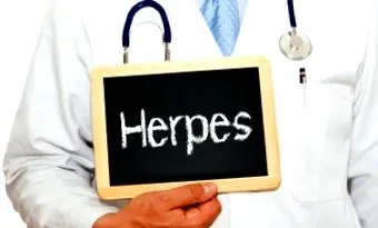 herpes