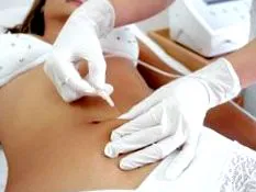 testmesoterápia