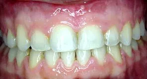 orală