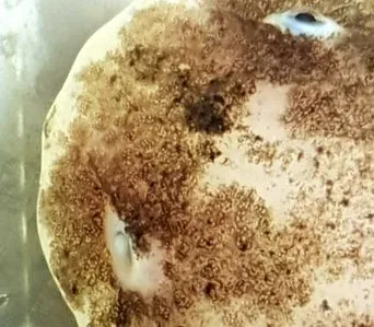 betegségek