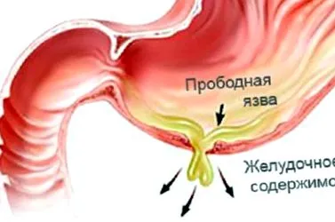 stomac