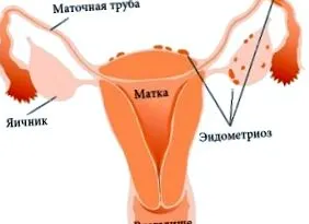 vertebrală