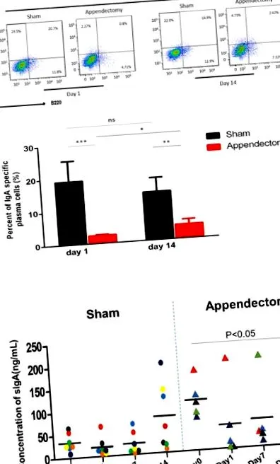 apendectomie
