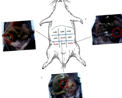 apendectomie