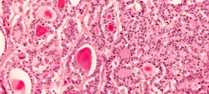 neuroendokrin