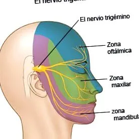 neuralgia