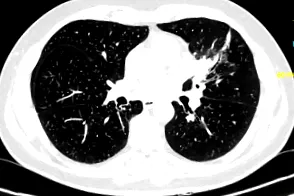 diagnostic