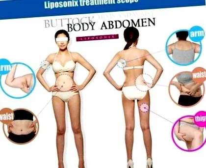 súlycsökkentő