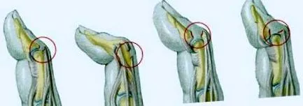 extensoare specifice
