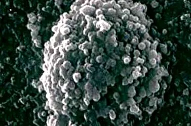 ureaplasma