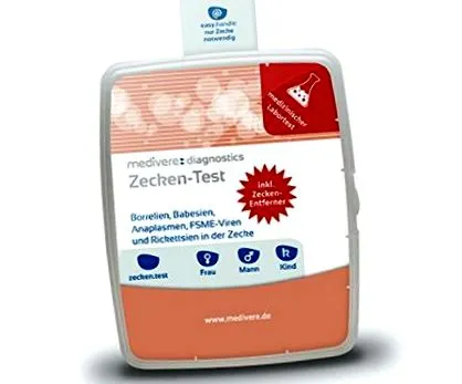 észlelje