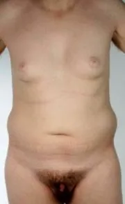 dermatológus