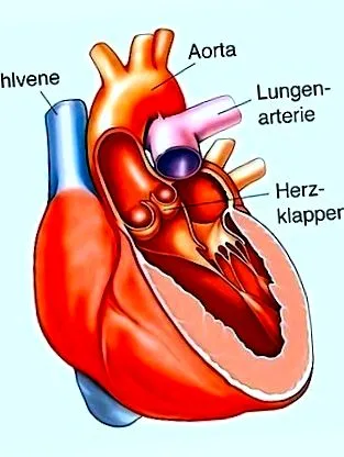 aortică