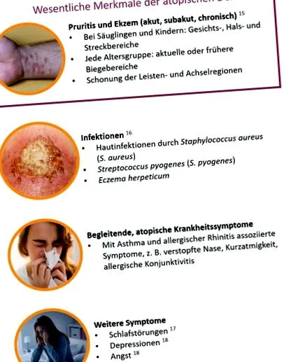 atópiás