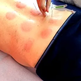 disc