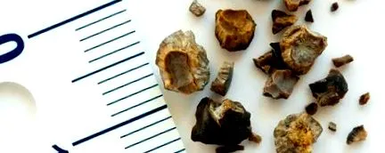 almaecettel