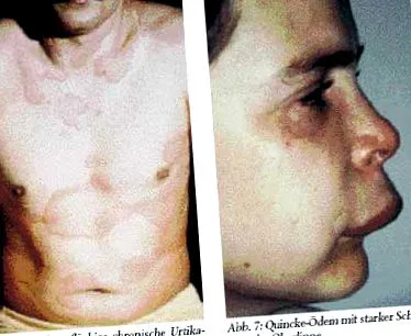 terapie diagnostic