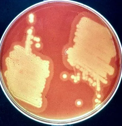 Escherichia coli
