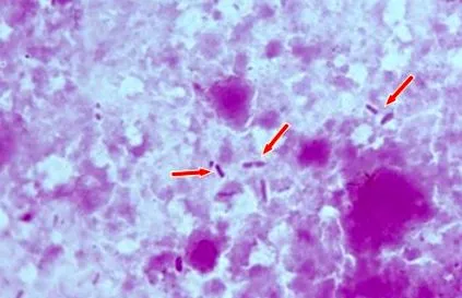 Escherichia coli