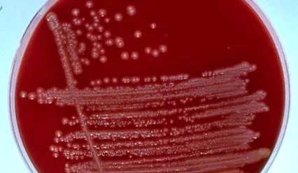 Escherichia coli
