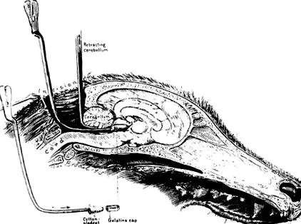 choroid plexus