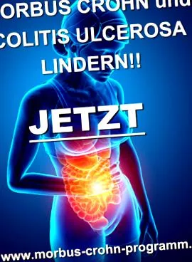 fekélyes vastagbélgyulladásban