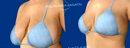 bagatin
