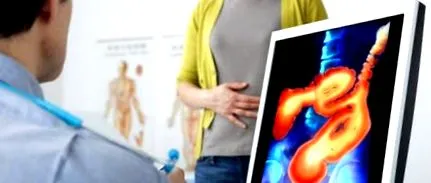 táplálkozás Crohn-betegség fekélyes