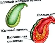 причини