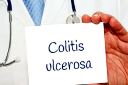 fekélyes vastagbélgyulladás esetén